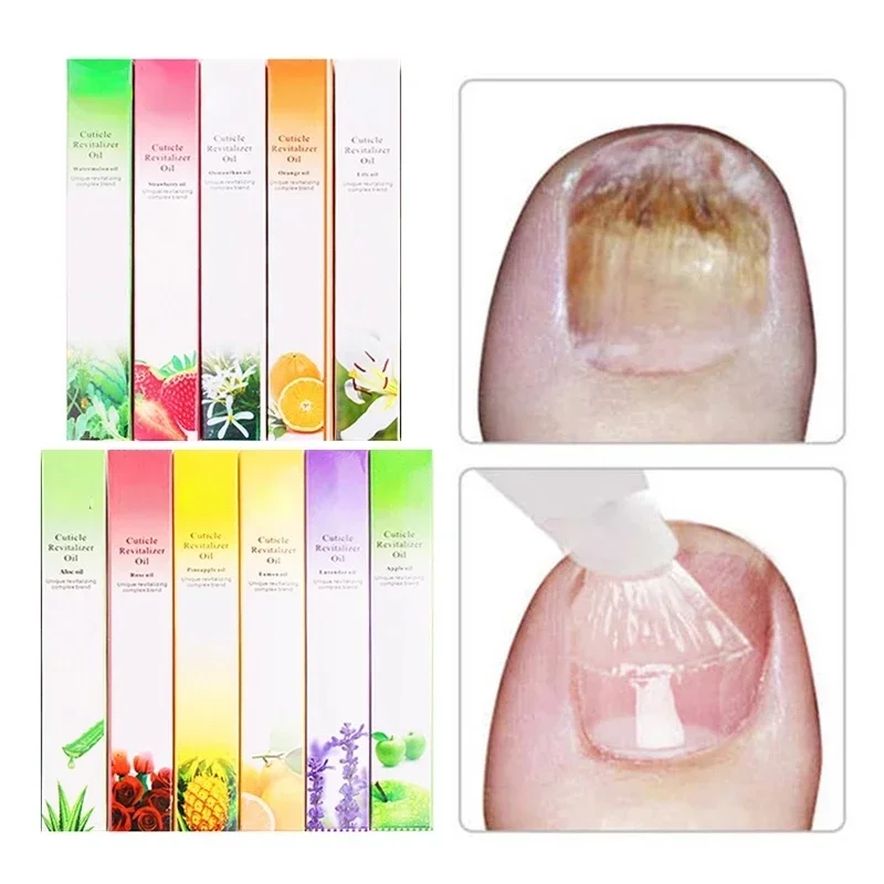 6PCS Cuticle Oil Pen Nail Nutr - Cuticle Oil Pen reseña y precio
